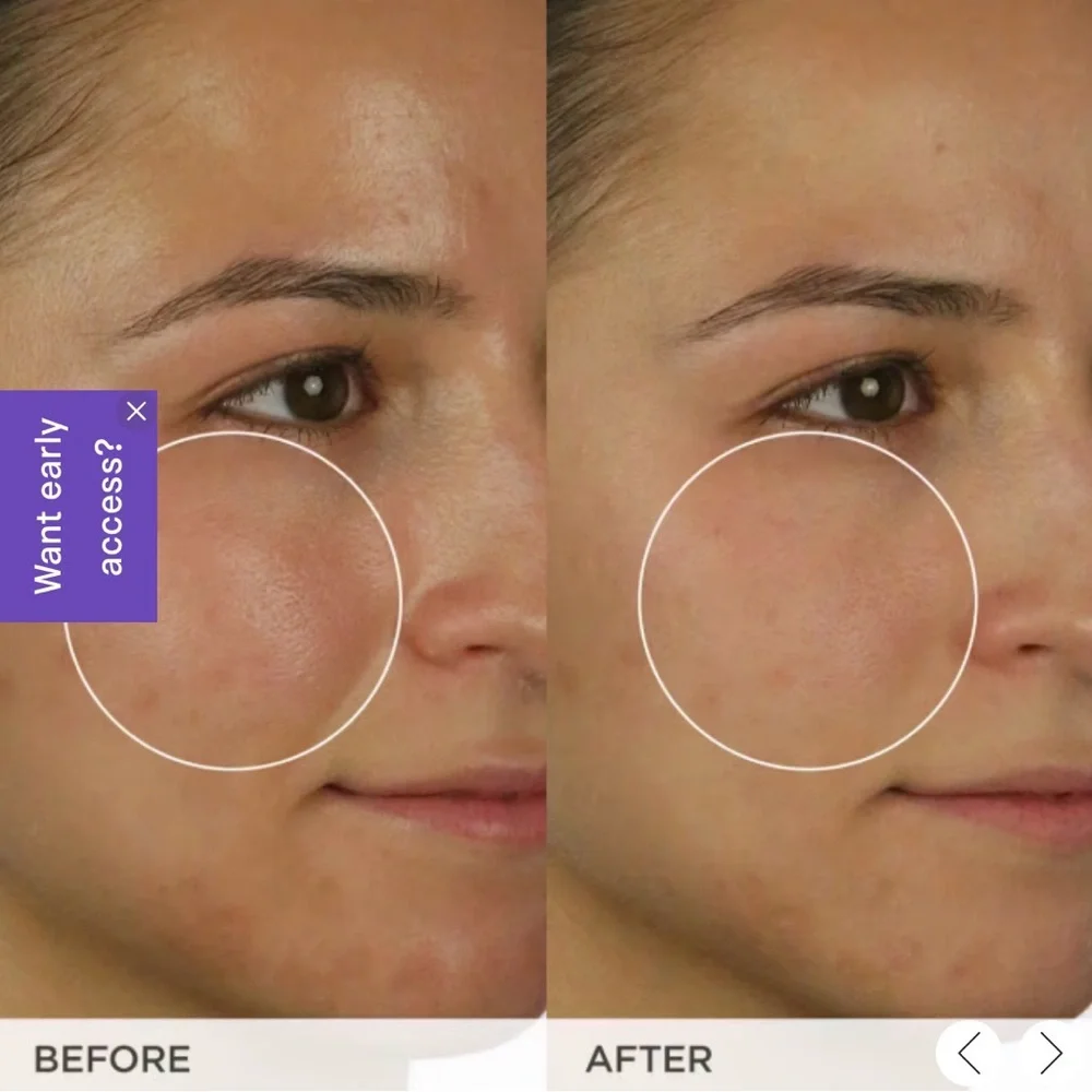 Tatcha The Matcha Cleanse Daily Clarifying Gel Cleanser Face Wash 5.0 oz - Picture 3 of 4